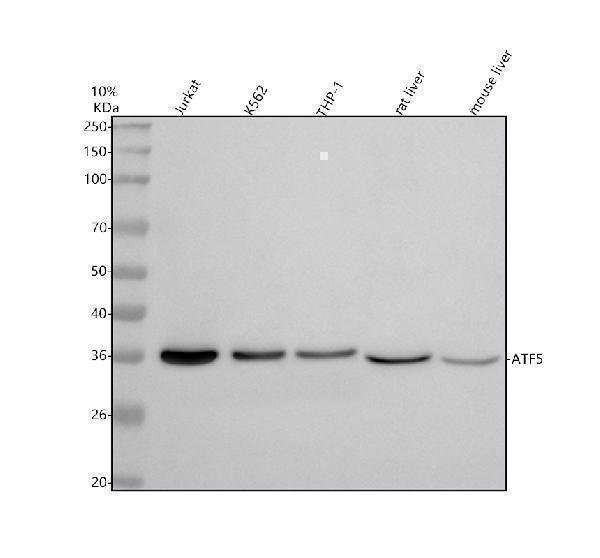 Western blot analysis of ATF5 using anti-ATF5 antibody (M02792)