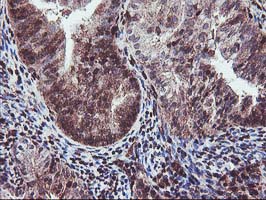 m02793 1 anti setd7 mouse monoclonal antibody clone id oti2d10 ihc testing 6