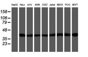 m02793 1 anti setd7 mouse monoclonal antibody clone id oti2d10 wb testing 3