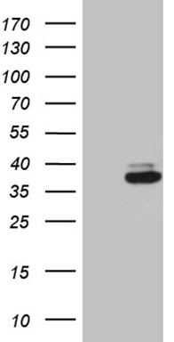 HEK293T cells were transfected with the pCMV6-ENTRY control (Left lane) or pCMV6-ENTRY RCAN1 (Right lane) cDNA for 48 hrs and lysed