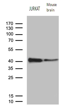Western blot analysis of extracts (35ug) from jurkat cell line and mouse brain tissue lysate by using anti-RCAN1 monoclonal antibody (1:500)