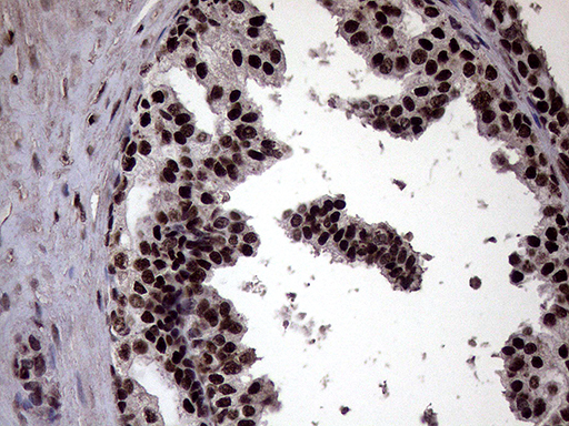 m02797 anti xrn2 mouse monoclonal antibody clone id oti5f4 ihc testing 11
