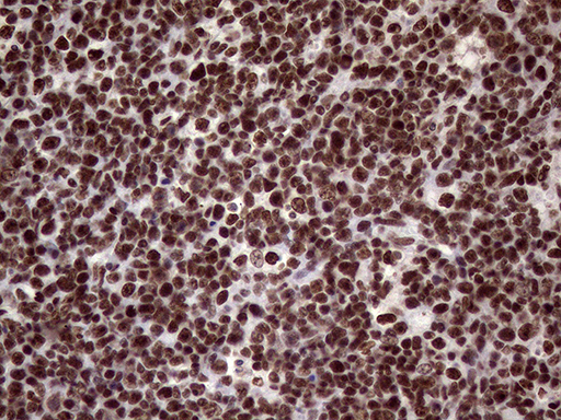 m02797 anti xrn2 mouse monoclonal antibody clone id oti5f4 ihc testing 12