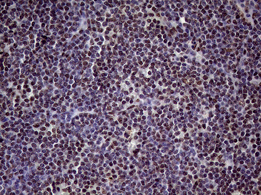 m02797 anti xrn2 mouse monoclonal antibody clone id oti5f4 ihc testing 13
