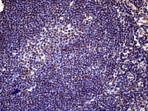 m02797 anti xrn2 mouse monoclonal antibody clone id oti5f4 ihc testing 14