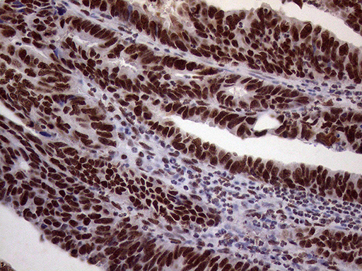 m02797 anti xrn2 mouse monoclonal antibody clone id oti5f4 ihc testing 15