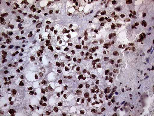 m02797 anti xrn2 mouse monoclonal antibody clone id oti5f4 ihc testing 17