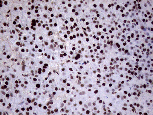 m02797 anti xrn2 mouse monoclonal antibody clone id oti5f4 ihc testing 18