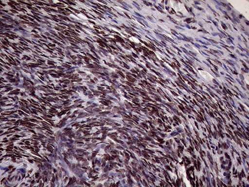 Immunohistochemical staining of paraffin-embedded Human Ovary tissue within the normal limits using anti-XRN2 mouse monoclonal antibody