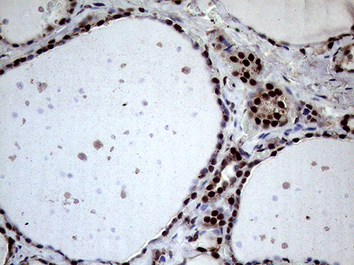 m02797 anti xrn2 mouse monoclonal antibody clone id oti5f4 ihc testing 6