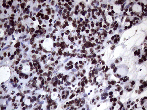 m02797 anti xrn2 mouse monoclonal antibody clone id oti5f4 ihc testing 7