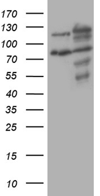 HEK293T cells were transfected with the pCMV6-ENTRY control (Left lane) or pCMV6-ENTRY XRN2 (Right lane) cDNA for 48 hrs and lysed