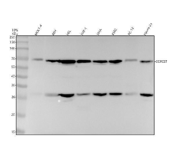 Western blot analysis of COREST using anti-COREST antibody (M02799-1)