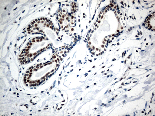 Immunohistochemical staining of paraffin-embedded Human breast tissue within the normal limits using anti-RCOR1 mouse monoclonal antibody