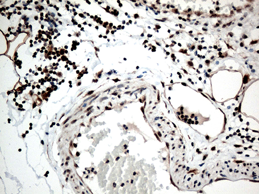 Immunohistochemical staining of paraffin-embedded Human appendix tissue within the normal limits using anti-RCOR1 mouse monoclonal antibody