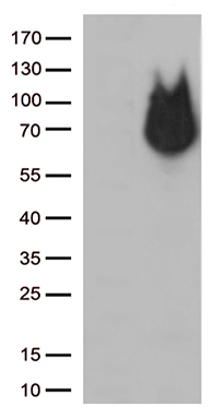 HEK293T cells were transfected with the pCMV6-ENTRY control (Left lane) or pCMV6-ENTRY RCOR1 (Right lane) cDNA for 48 hrs and lysed