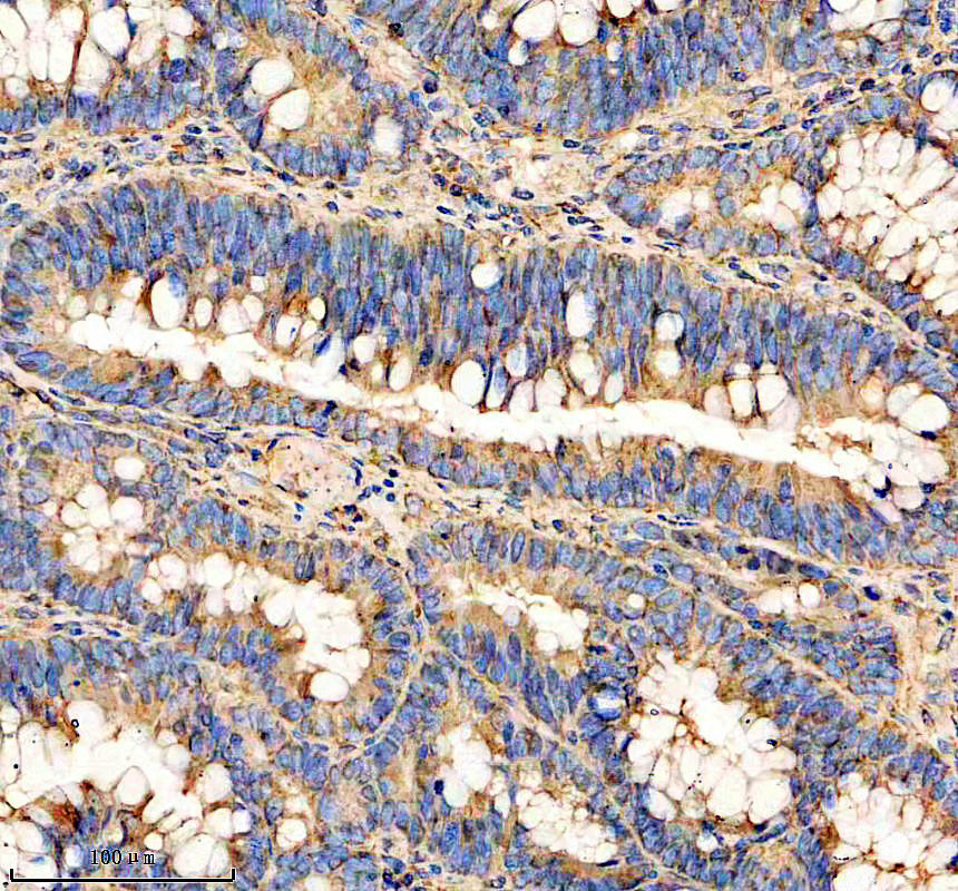 m02802 adamts5 primary antibodies ihc testing 1