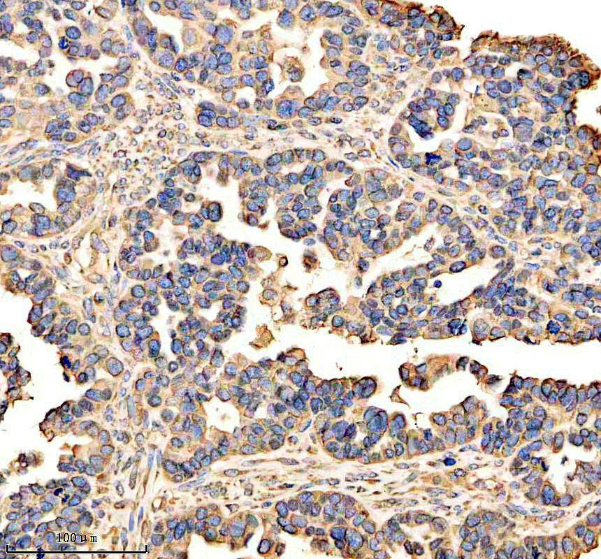 m02802 adamts5 primary antibodies ihc testing 2