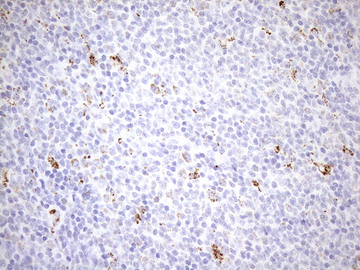 m02803 1 anti cyclophilin f ppif mouse monoclonal antibody clone id oti1g8 ihc testing 5