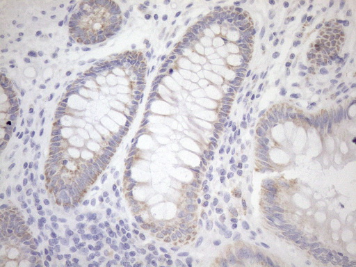 m02803 1 anti cyclophilin f ppif mouse monoclonal antibody clone id oti1g8 ihc testing 7