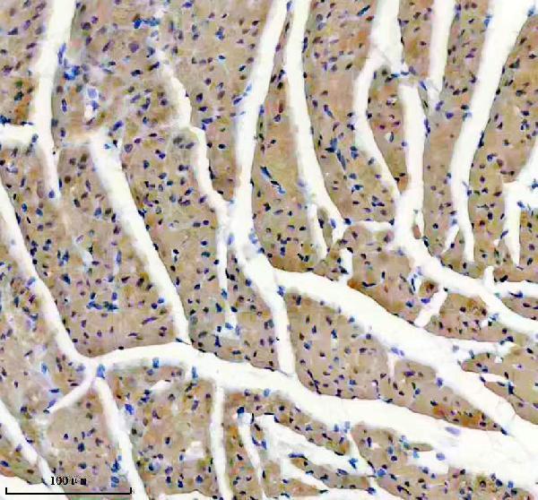 m02808 myh6 primary antibodies ihc testing 1