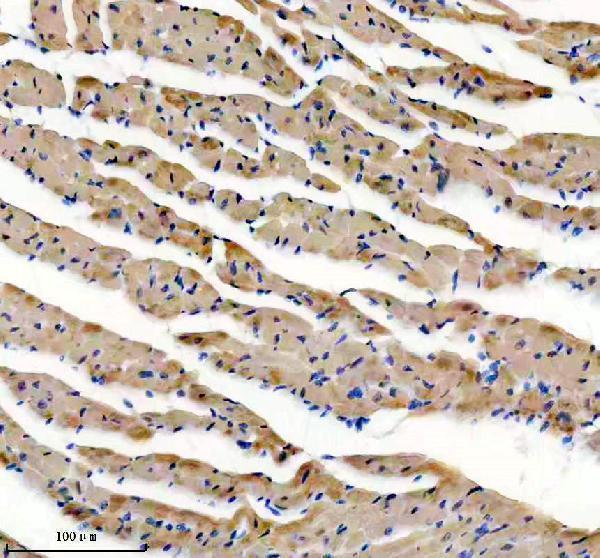 m02808 myh6 primary antibodies ihc testing 2