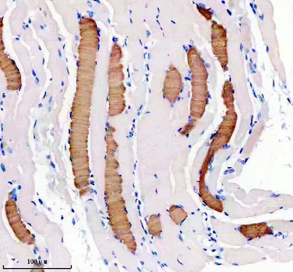 m02808 myh6 primary antibodies ihc testing 3