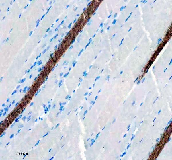 m02808 myh6 primary antibodies ihc testing 4