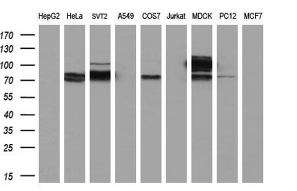m02809 1 anti acetyl coa synthetase acss2 mouse monoclonal antibody clone id oti3h4 wb testing 2