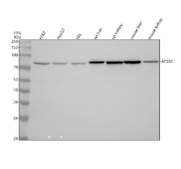  Western blot analysis of ACSS2 using anti-ACSS2 antibody (M02809)