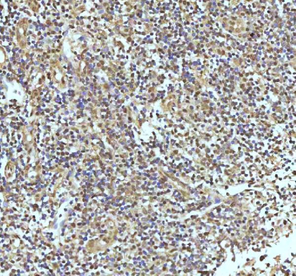 m02810 uba1 primary antibodies ihc testing 13