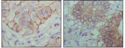 m02811 ephb1 primary antibodies ihc testing 1