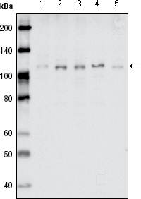 m02811 ephb1 primary antibodies wb testing 2