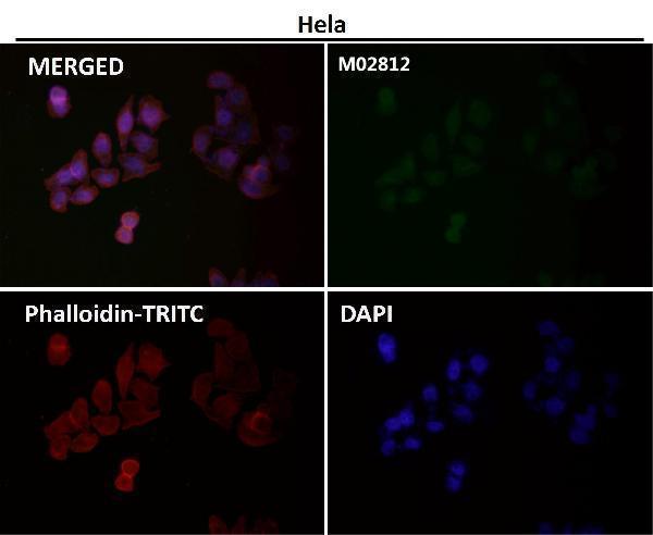 Immunofluorescent analysis using the Antibody at 1:50 dilution
