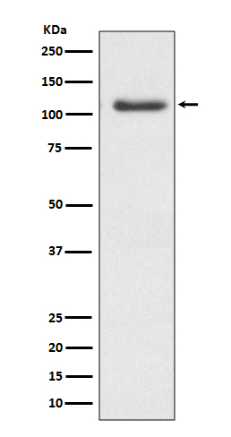 Western blot analysis of ERK5 expression in Hela cell lysate