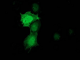m02813 1 anti pnmt mouse monoclonal antibody clone id oti2d5 if testing 6