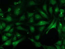 m02813 1 anti pnmt mouse monoclonal antibody clone id oti2d5 if testing 7