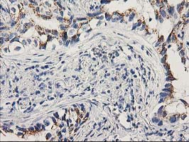 m02813 1 anti pnmt mouse monoclonal antibody clone id oti2d5 ihc testing 2