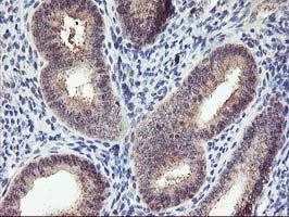 m02813 anti pnmt mouse monoclonal antibody clone id oti1d2 ihc testing 4