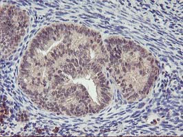 m02813 anti pnmt mouse monoclonal antibody clone id oti1d2 ihc testing 5