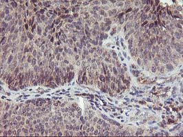 m02813 anti pnmt mouse monoclonal antibody clone id oti1d2 ihc testing 6