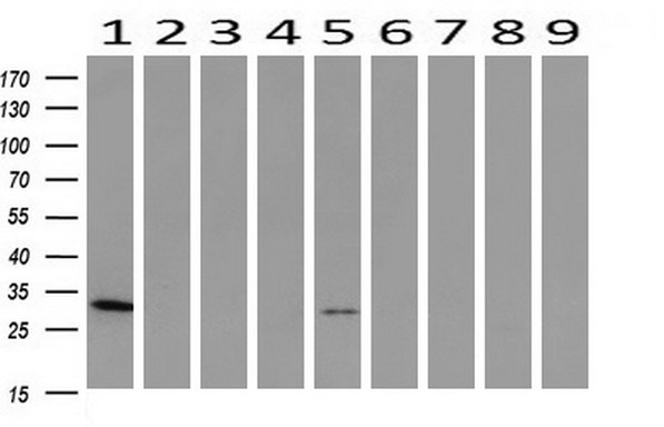 m02813 anti pnmt mouse monoclonal antibody clone id oti1d2 wb testing 2