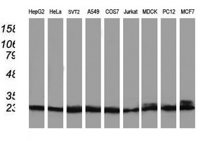 m02813 anti pnmt mouse monoclonal antibody clone id oti1d2 wb testing 3