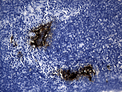 m02814 1 anti cd299 clec4m mouse monoclonal antibody clone id oti7d12 ihc testing 2