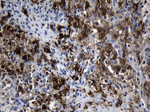 m02814 anti cd299 clec4m mouse monoclonal antibody clone id oti10c3 ihc testing 2