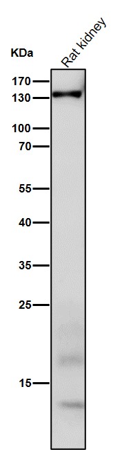 All lanes use the Antibody at 1:1K dilution for 1 hour at room temperature