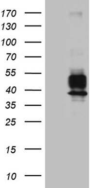 HEK293T cells were transfected with the pCMV6-ENTRY control (Left lane) or pCMV6-ENTRY VTCN1 (Right lane) cDNA for 48 hrs and lysed