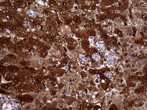 m02825 1 anti cbr1 mouse monoclonal antibody clone id oti4b4 ihc testing 5