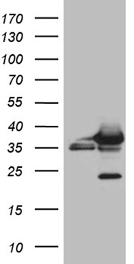 m02825 1 anti cbr1 mouse monoclonal antibody clone id oti4b4 wb testing 1