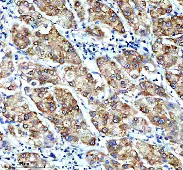 m02825 3 cbr1 primary antibodies ihc testing 2